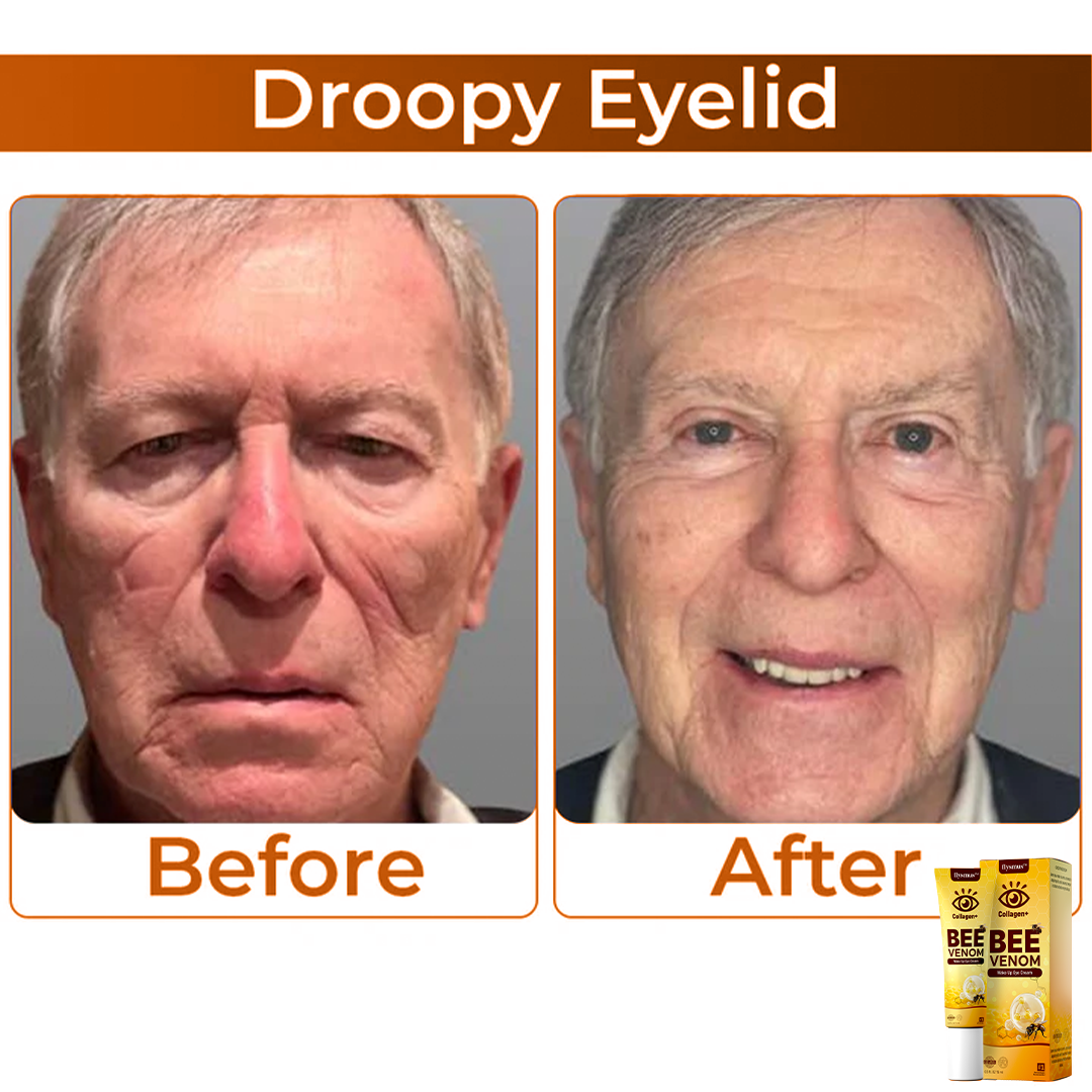 Bijenvenom+Collageen : Verfris uw blik