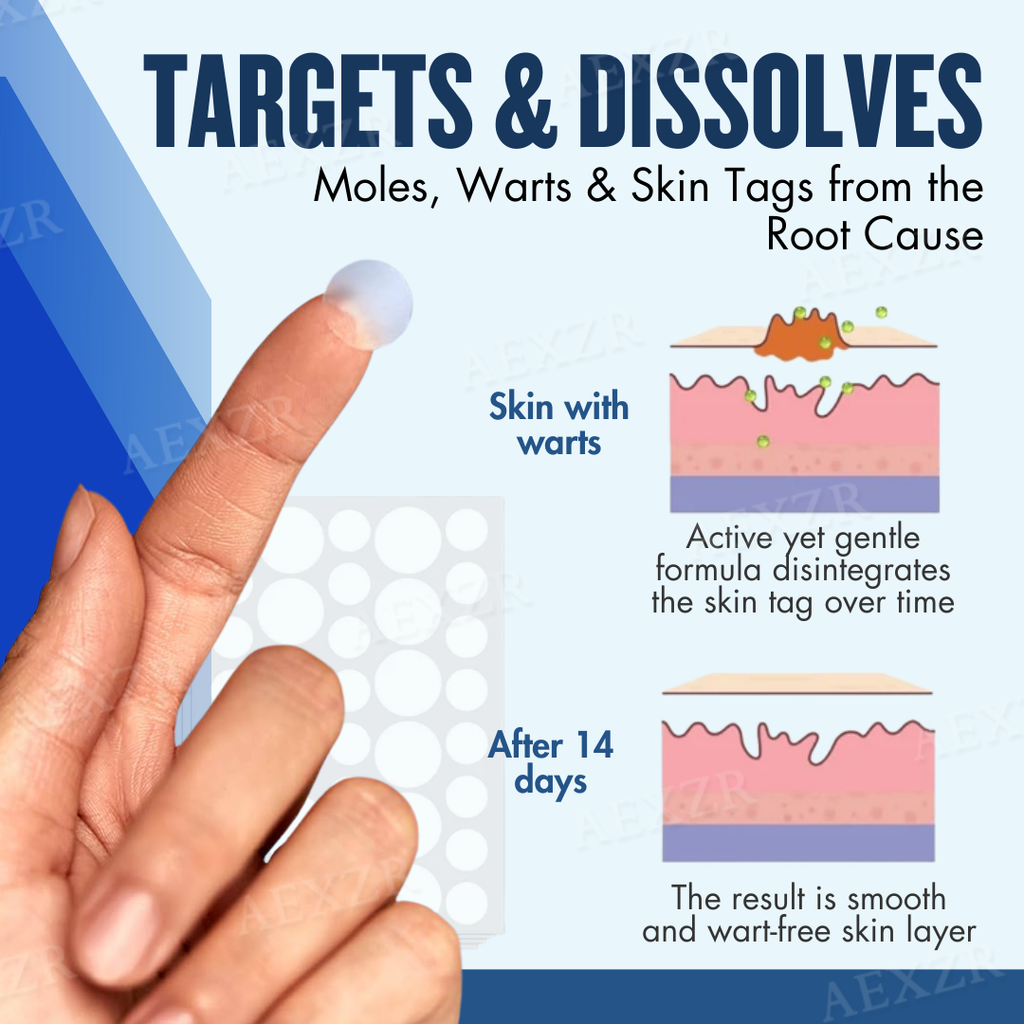 Patch – Eliminação eficaz de grãos de beleza e verrugas 