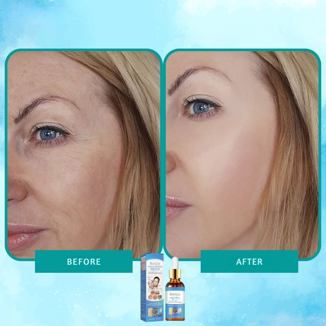 Intensi ryppyjä vastaan botox-seerumi 