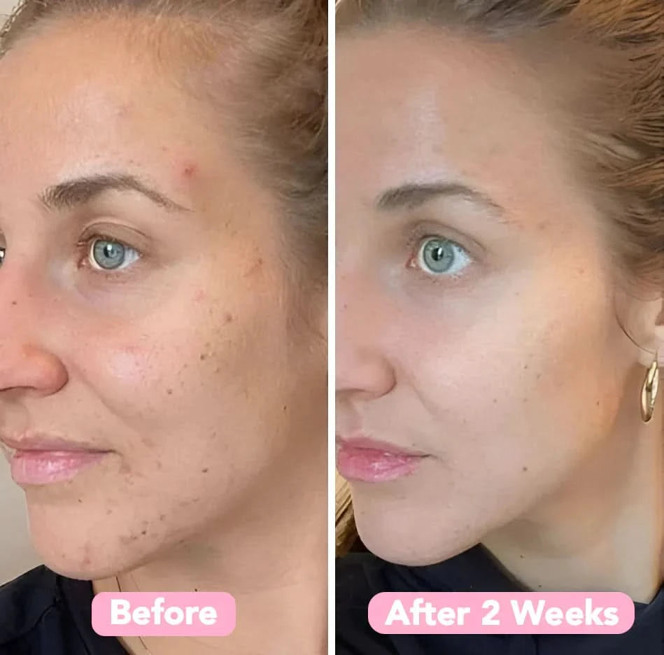 Esponja de curcuma – Pele limpa e purificada naturalmente (x40) 